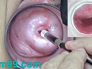 Japanese Endoscope Camera medial Cervix Cam buy Vagina